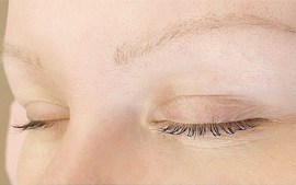 Удаление микроблейдинга бровей лазером фото - The Lashes